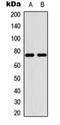 Protein Inhibitor Of Activated STAT 4 antibody, orb256749, Biorbyt, Western Blot image 