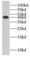 Family With Sequence Similarity 71 Member F2 antibody, FNab02993, FineTest, Western Blot image 