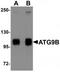 Autophagy Related 9B antibody, TA320163, Origene, Western Blot image 