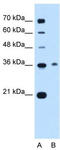 Chromosome 11 Open Reading Frame 54 antibody, TA346127, Origene, Western Blot image 