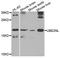 Ubiquitin Conjugating Enzyme E2 N Like (Gene/Pseudogene) antibody, A8381, ABclonal Technology, Western Blot image 