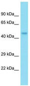 Nucleoporin 50 antibody, TA340153, Origene, Western Blot image 