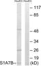 Protein S100-A7-like 2 antibody, PA5-39374, Invitrogen Antibodies, Western Blot image 