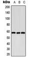 Cytochrome P450 Family 8 Subfamily B Member 1 antibody, LS-C352095, Lifespan Biosciences, Western Blot image 