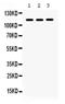 Integrin Subunit Alpha 2b antibody, PA5-79527, Invitrogen Antibodies, Western Blot image 