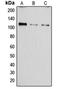 ATPase Sarcoplasmic/Endoplasmic Reticulum Ca2+ Transporting 1 antibody, orb213591, Biorbyt, Western Blot image 