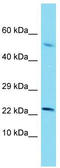 CTD Small Phosphatase 2 antibody, TA342201, Origene, Western Blot image 