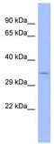 Serine And Arginine Rich Splicing Factor 10 antibody, TA345979, Origene, Western Blot image 