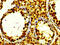 Histone Cluster 1 H2B Family Member K antibody, CSB-RA010411A0HU, Cusabio, Immunohistochemistry paraffin image 