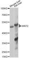 Wnt Family Member 2 antibody, LS-C748607, Lifespan Biosciences, Western Blot image 
