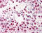 ERCC Excision Repair 3, TFIIH Core Complex Helicase Subunit antibody, TA318145, Origene, Immunohistochemistry paraffin image 