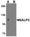 NLR Family Pyrin Domain Containing 3 antibody, NBP1-77080, Novus Biologicals, Western Blot image 