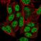 Zinc Finger Protein 556 antibody, HPA060593, Atlas Antibodies, Immunofluorescence image 