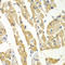 Histamine N-Methyltransferase antibody, LS-C332135, Lifespan Biosciences, Immunohistochemistry paraffin image 