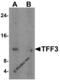 Itf antibody, 6113, ProSci Inc, Western Blot image 