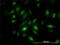NIMA Related Kinase 10 antibody, H00152110-M01, Novus Biologicals, Immunocytochemistry image 