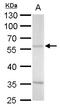 Arginine decarboxylase antibody, GTX120705, GeneTex, Western Blot image 