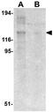 NLR Family Pyrin Domain Containing 8 antibody, GTX85155, GeneTex, Western Blot image 
