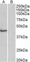 TATA-Box Binding Protein antibody, MBS422712, MyBioSource, Western Blot image 