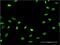 Protein Tyrosine Phosphatase Non-Receptor Type 22 antibody, H00026191-M02, Novus Biologicals, Immunofluorescence image 