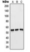 6-Phosphofructo-2-Kinase/Fructose-2,6-Biphosphatase 1 antibody, orb214382, Biorbyt, Western Blot image 