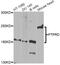 Protein Tyrosine Phosphatase Receptor Type D antibody, A8559, ABclonal Technology, Western Blot image 