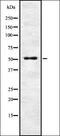Ectonucleoside Triphosphate Diphosphohydrolase 2 antibody, orb337094, Biorbyt, Western Blot image 