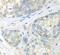 Cullin 3 antibody, FNab02075, FineTest, Immunohistochemistry paraffin image 