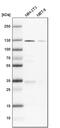 PRK1 antibody, PA5-52036, Invitrogen Antibodies, Western Blot image 