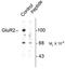 Glutamate Ionotropic Receptor AMPA Type Subunit 2 antibody, TA309156, Origene, Western Blot image 