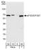 Eukaryotic Translation Initiation Factor 3 Subunit D antibody, A301-758A, Bethyl Labs, Western Blot image 