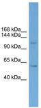 Zinc Finger Protein 628 antibody, TA339780, Origene, Western Blot image 