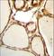 Holliday Junction Recognition Protein antibody, LS-C164907, Lifespan Biosciences, Immunohistochemistry frozen image 