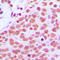 Jun Proto-Oncogene, AP-1 Transcription Factor Subunit antibody, LS-C352428, Lifespan Biosciences, Immunohistochemistry paraffin image 