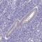 Chromosome 19 Open Reading Frame 81 antibody, PA5-63824, Invitrogen Antibodies, Immunohistochemistry frozen image 