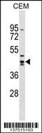 Zinc Finger And SCAN Domain Containing 9 antibody, 59-233, ProSci, Western Blot image 