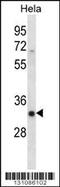 Serine/arginine-rich splicing factor 7 antibody, 56-336, ProSci, Western Blot image 