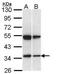 SH3 Domain Containing GRB2 Like 1, Endophilin A2 antibody, GTX113548, GeneTex, Western Blot image 