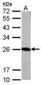 Glutathione S-transferase P 1 antibody, PA5-29558, Invitrogen Antibodies, Western Blot image 