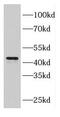 F-Box And Leucine Rich Repeat Protein 14 antibody, FNab03033, FineTest, Western Blot image 
