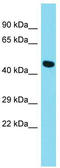 G Protein-Coupled Receptor 52 antibody, TA343248, Origene, Western Blot image 