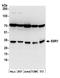 Signal Sequence Receptor Subunit 1 antibody, A304-977A, Bethyl Labs, Western Blot image 