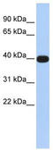 LIM Homeobox Transcription Factor 1 Alpha antibody, TA331106, Origene, Western Blot image 