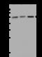 Katanin p60 ATPase-containing subunit A1 antibody, 203745-T32, Sino Biological, Western Blot image 