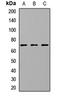 Cholesteryl Ester Transfer Protein antibody, LS-C667741, Lifespan Biosciences, Western Blot image 