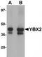 Y-box-binding protein 2 antibody, TA319913, Origene, Western Blot image 