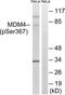 MDM4 Regulator Of P53 antibody, TA312001, Origene, Western Blot image 