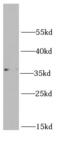 Ribosomal Protein L5 antibody, FNab07440, FineTest, Western Blot image 