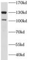 Insulin Receptor Substrate 1 antibody, FNab10261, FineTest, Western Blot image 