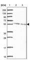DEAD-Box Helicase 19B antibody, NBP2-33462, Novus Biologicals, Western Blot image 